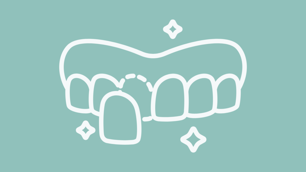 Dental Veneers in Tucson, AZ