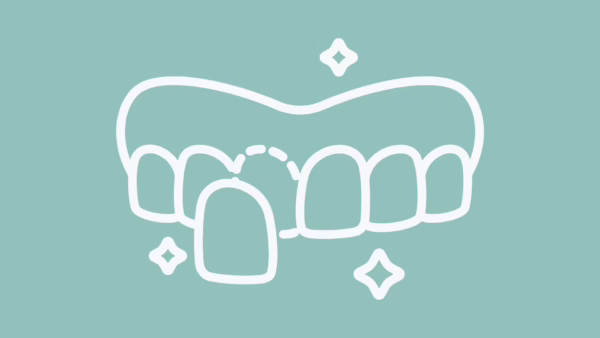 Dental Veneers in Tucson, AZ